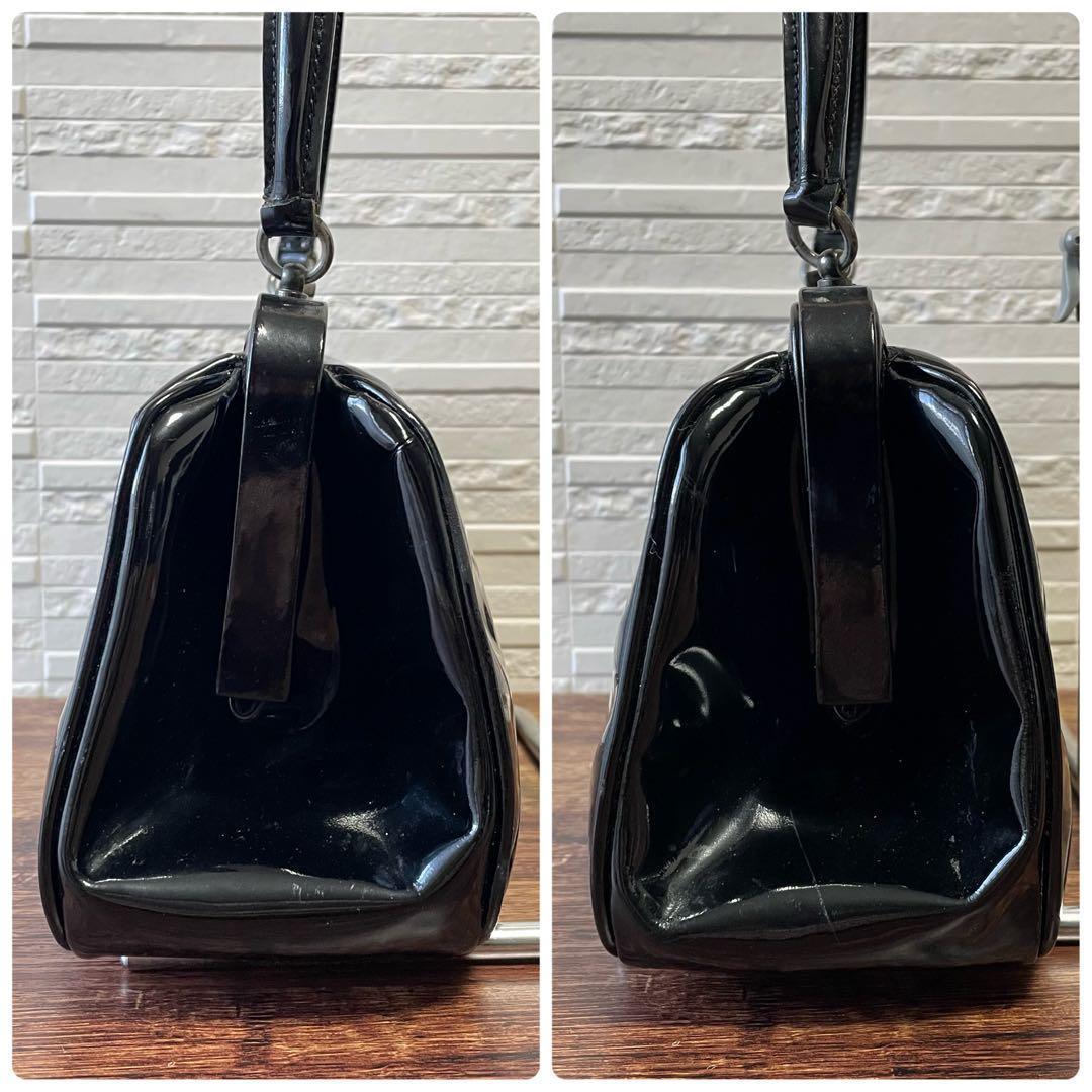 Prada Patent Patent Leather Hand Bag Kiss Lock Black — view 4